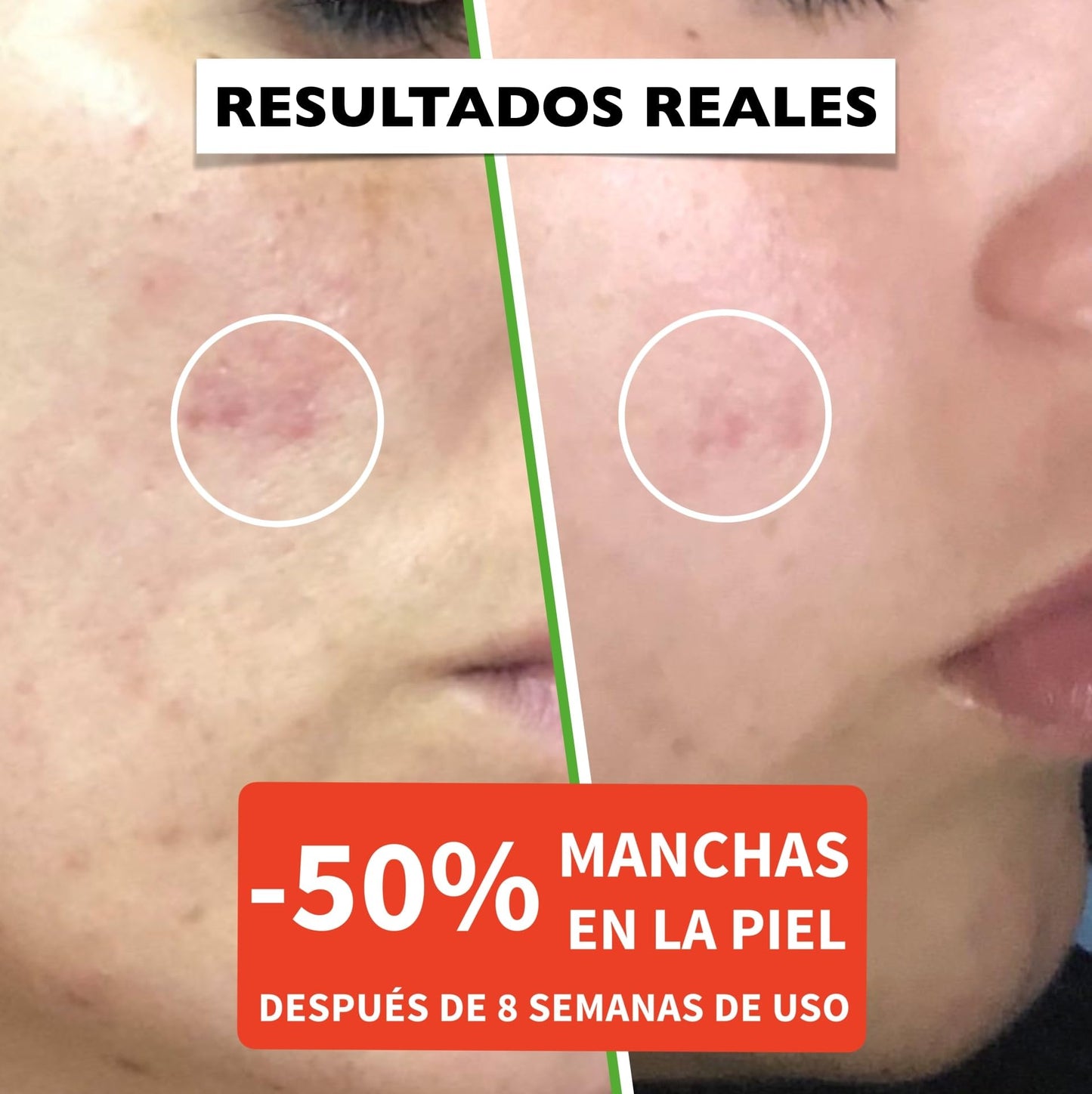 Nuestro Recomendado: Serum Facial con vitamina C , Cuídate